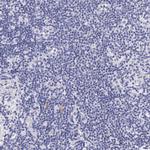 Cytokeratin 17 Antibody in Immunohistochemistry (Paraffin) (IHC (P))