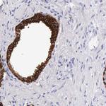 Cytokeratin 17 Antibody in Immunohistochemistry (Paraffin) (IHC (P))