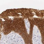 Cytokeratin 17 Antibody in Immunohistochemistry (Paraffin) (IHC (P))