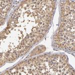 GNPDA1 Antibody in Immunohistochemistry (Paraffin) (IHC (P))