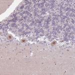 MLLT11 Antibody in Immunohistochemistry (Paraffin) (IHC (P))