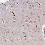 MLLT11 Antibody in Immunohistochemistry (Paraffin) (IHC (P))