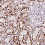 MLLT11 Antibody in Immunohistochemistry (Paraffin) (IHC (P))