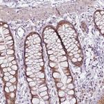 MLLT11 Antibody in Immunohistochemistry (Paraffin) (IHC (P))