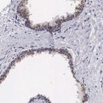 Arginase 2 Antibody in Immunohistochemistry (Paraffin) (IHC (P))