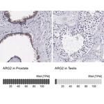 Arginase 2 Antibody