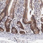 MTHFD1 Antibody in Immunohistochemistry (Paraffin) (IHC (P))