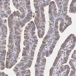 MTHFD1 Antibody in Immunohistochemistry (Paraffin) (IHC (P))