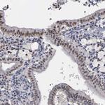 Kaiso Antibody in Immunohistochemistry (Paraffin) (IHC (P))