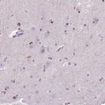 HSPA2 Antibody in Immunohistochemistry (Paraffin) (IHC (P))