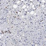 G6PD Antibody in Immunohistochemistry (Paraffin) (IHC (P))