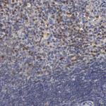 G6PD Antibody in Immunohistochemistry (Paraffin) (IHC (P))