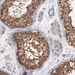 G6PD Antibody in Immunohistochemistry (Paraffin) (IHC (P))