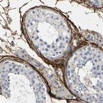 Fibulin 5 Antibody in Immunohistochemistry (Paraffin) (IHC (P))