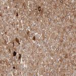 C4BPA Antibody in Immunohistochemistry (Paraffin) (IHC (P))