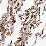 C4BPA Antibody in Immunohistochemistry (Paraffin) (IHC (P))