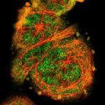 STAT1 Antibody in Immunocytochemistry (ICC/IF)