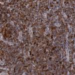 STAT1 Antibody in Immunohistochemistry (Paraffin) (IHC (P))