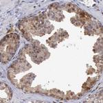 STAT1 Antibody in Immunohistochemistry (Paraffin) (IHC (P))