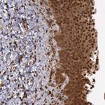 STAT1 Antibody in Immunohistochemistry (Paraffin) (IHC (P))