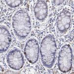 TYRP1 Antibody in Immunohistochemistry (Paraffin) (IHC (P))