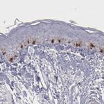 TYRP1 Antibody in Immunohistochemistry (Paraffin) (IHC (P))