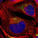 Aconitase 2 Antibody in Immunocytochemistry (ICC/IF)