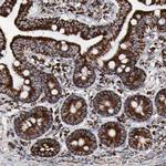 Aconitase 2 Antibody in Immunohistochemistry (Paraffin) (IHC (P))