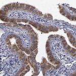 CrkL Antibody in Immunohistochemistry (Paraffin) (IHC (P))