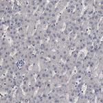 CrkL Antibody in Immunohistochemistry (Paraffin) (IHC (P))