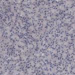 CrkL Antibody in Immunohistochemistry (Paraffin) (IHC (P))