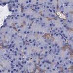 Filamin A Antibody in Immunohistochemistry (Paraffin) (IHC (P))