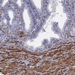 Filamin A Antibody in Immunohistochemistry (Paraffin) (IHC (P))