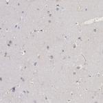 Lyn Antibody in Immunohistochemistry (Paraffin) (IHC (P))