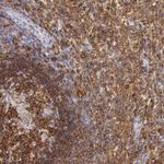 Lyn Antibody in Immunohistochemistry (Paraffin) (IHC (P))