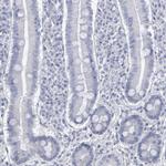 DMC1 Antibody in Immunohistochemistry (Paraffin) (IHC (P))