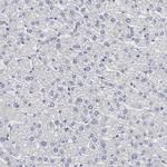 DMC1 Antibody in Immunohistochemistry (Paraffin) (IHC (P))