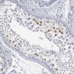 DMC1 Antibody in Immunohistochemistry (Paraffin) (IHC (P))