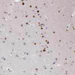 MSK1 Antibody in Immunohistochemistry (Paraffin) (IHC (P))