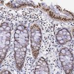 MSK1 Antibody in Immunohistochemistry (Paraffin) (IHC (P))