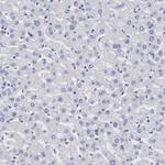 MSK1 Antibody in Immunohistochemistry (Paraffin) (IHC (P))