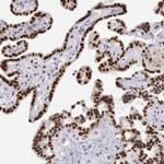 MSK1 Antibody in Immunohistochemistry (Paraffin) (IHC (P))