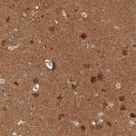 B-Raf Antibody in Immunohistochemistry (Paraffin) (IHC (P))