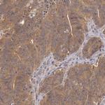 B-Raf Antibody in Immunohistochemistry (Paraffin) (IHC (P))