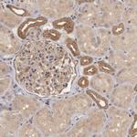 B-Raf Antibody in Immunohistochemistry (Paraffin) (IHC (P))