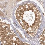 B-Raf Antibody in Immunohistochemistry (Paraffin) (IHC (P))