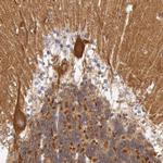 MYO5A Antibody in Immunohistochemistry (Paraffin) (IHC (P))