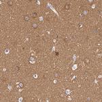 MYO5A Antibody in Immunohistochemistry (Paraffin) (IHC (P))