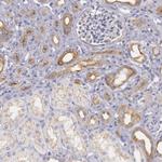 MYO5A Antibody in Immunohistochemistry (Paraffin) (IHC (P))