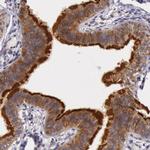 PCTAIRE1 Antibody in Immunohistochemistry (Paraffin) (IHC (P))